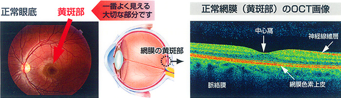 正常眼底と正常網膜のOCT画像